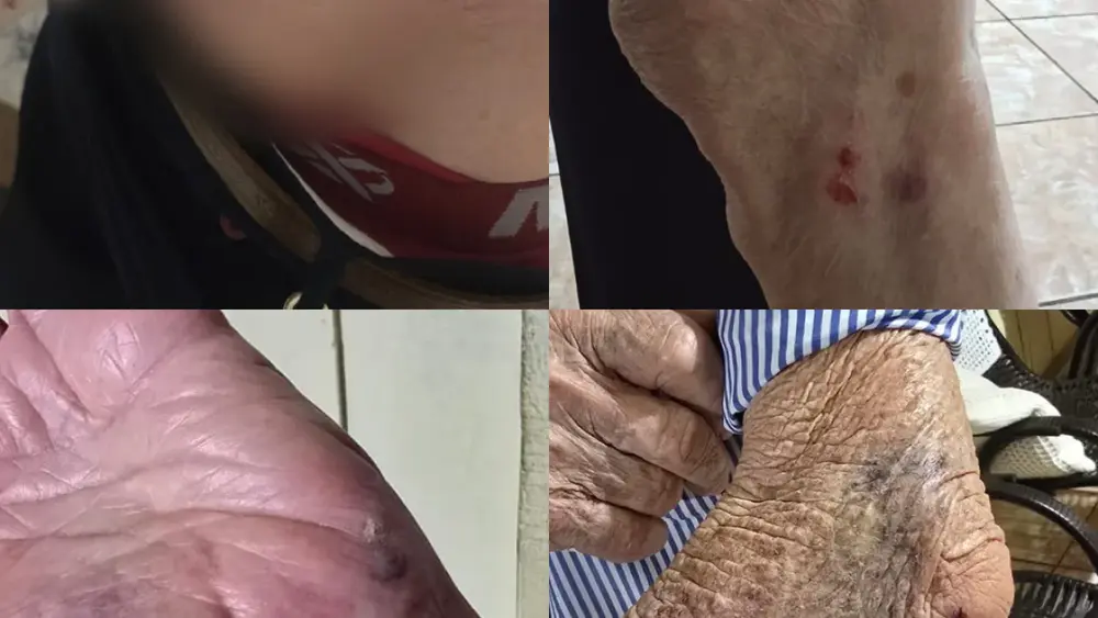 Idoso de 87 anos é derrubado e mordido por cachorro na Vila Nasser